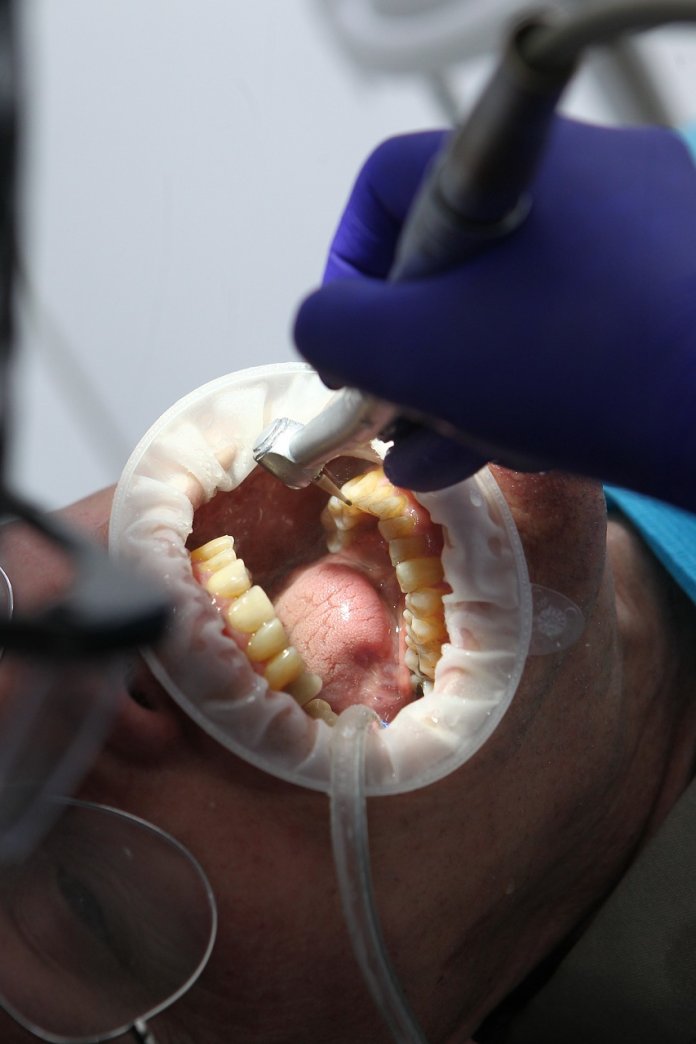 rehamedgorzow-2023-04 - wybielanie zębów-1.jpg